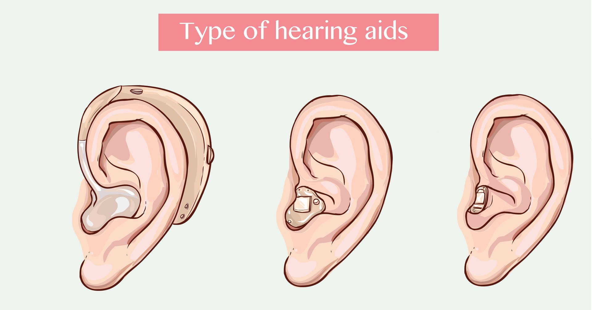 Hearing Aid Styles Wolfpack Hearing Clinic in Fayetteville, AR