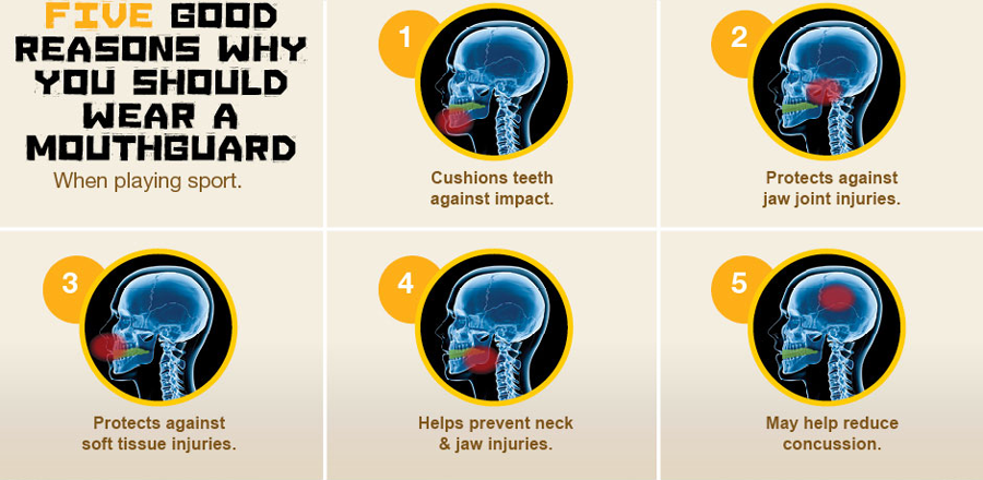 Blackwood Smiles Mouth Guard Chart