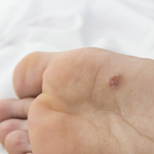 Family Foot & Ankle Clinic Valparaiso, IN A Clinic for Foot Pain Relief