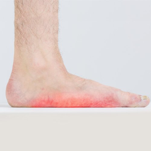 Family Foot & Ankle Clinic Valparaiso, IN A Clinic for Foot Pain Relief