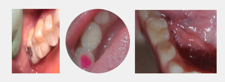 Paediatric dentist | All Smiles in Finchley