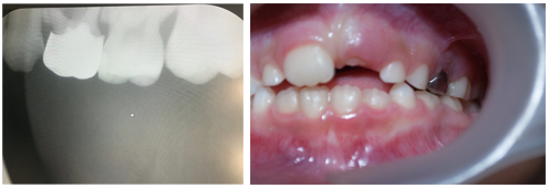 Paediatric dentist | All Smiles in Finchley