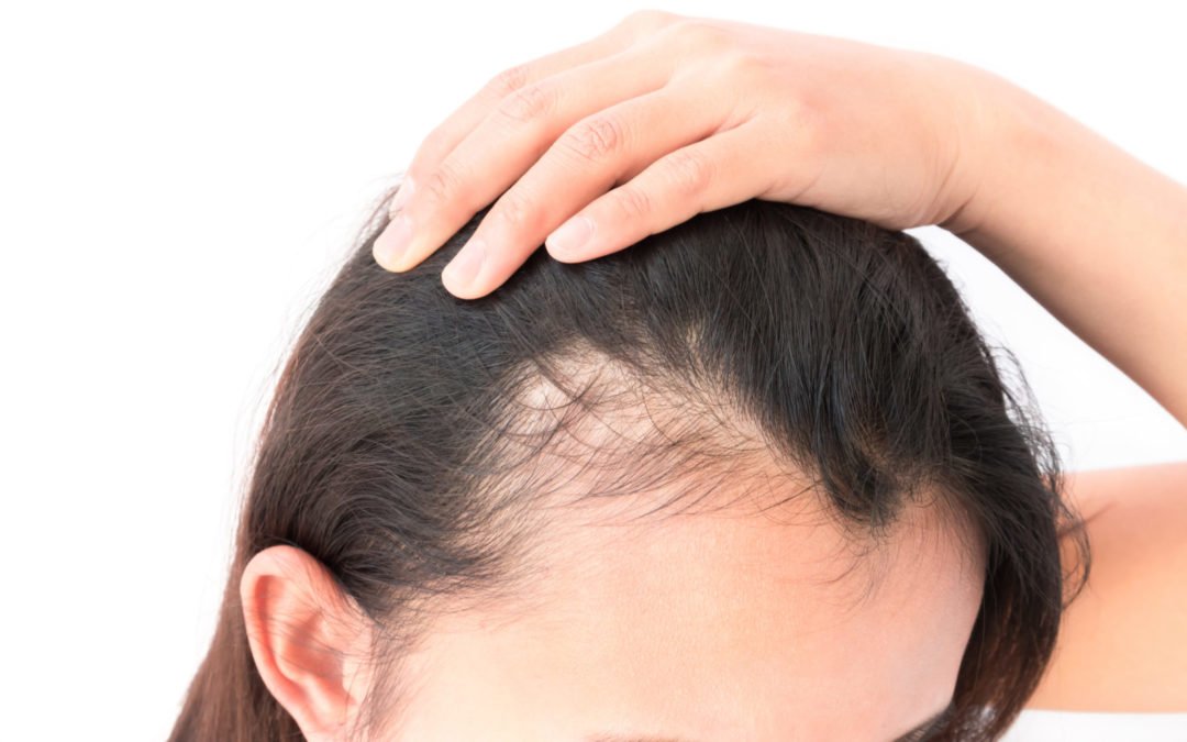 Hair Thinning Treatment