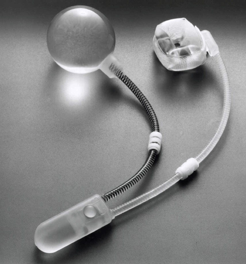 SFINTERE ARTIFICIALE