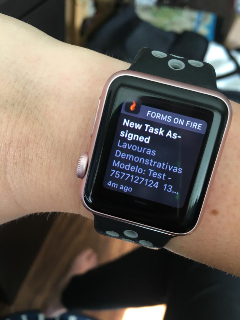 Apple Watch Compatible