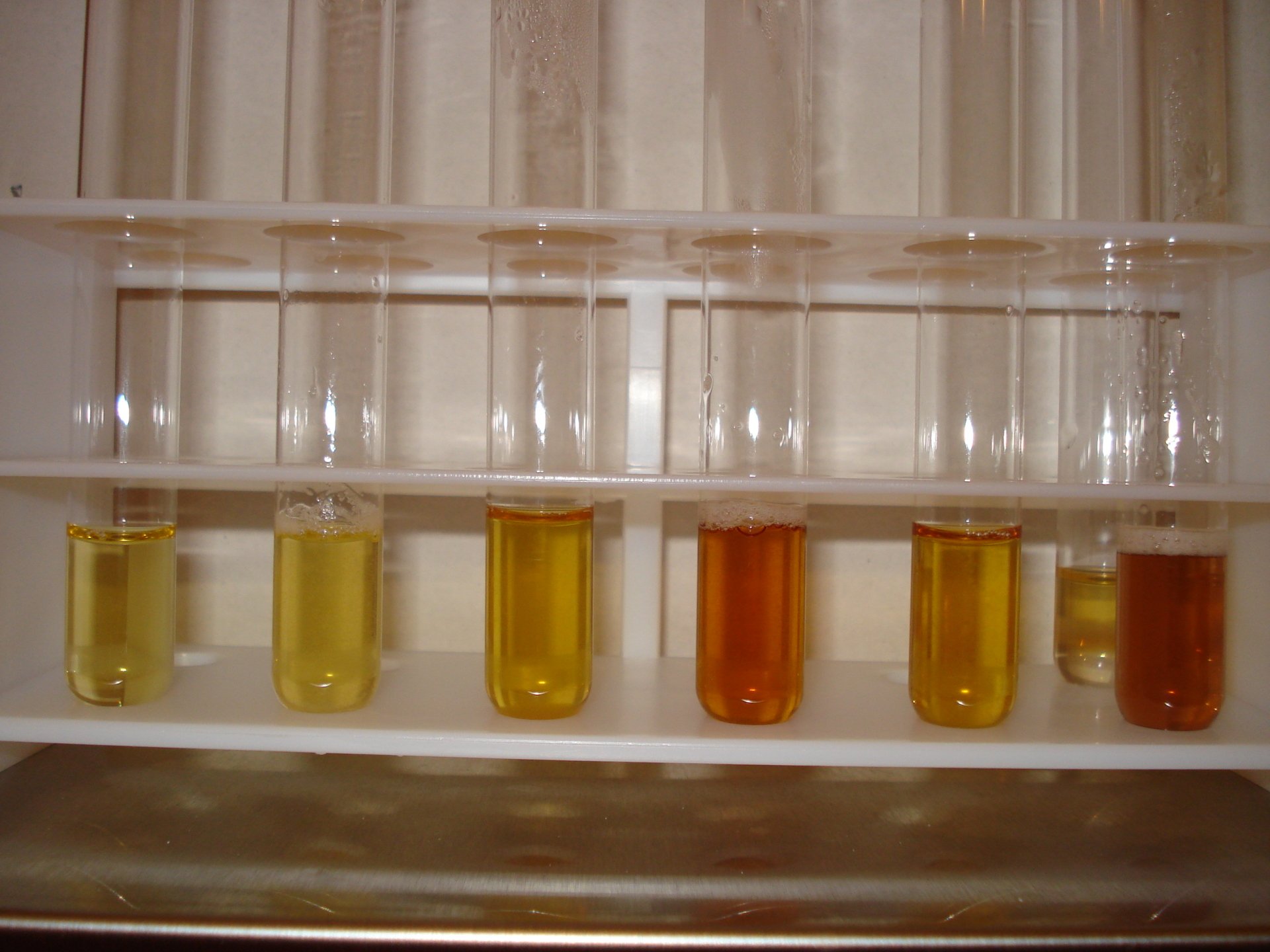 Die Traditionelle Harndiagnostik – ein sehr altes Verfahren in der naturheilkundlichen Diagnostik