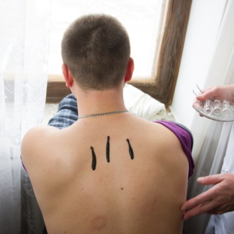 Naturheilkunde gegen Rückenschmerzen – Welche Therapie ist für mich geeignet?