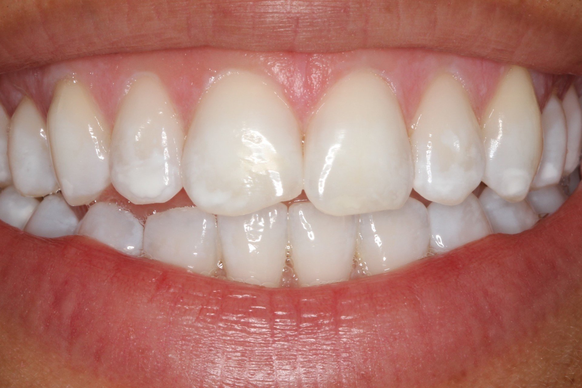 NHS & Private Dentist in StokeonTrent Pall Mall Dental