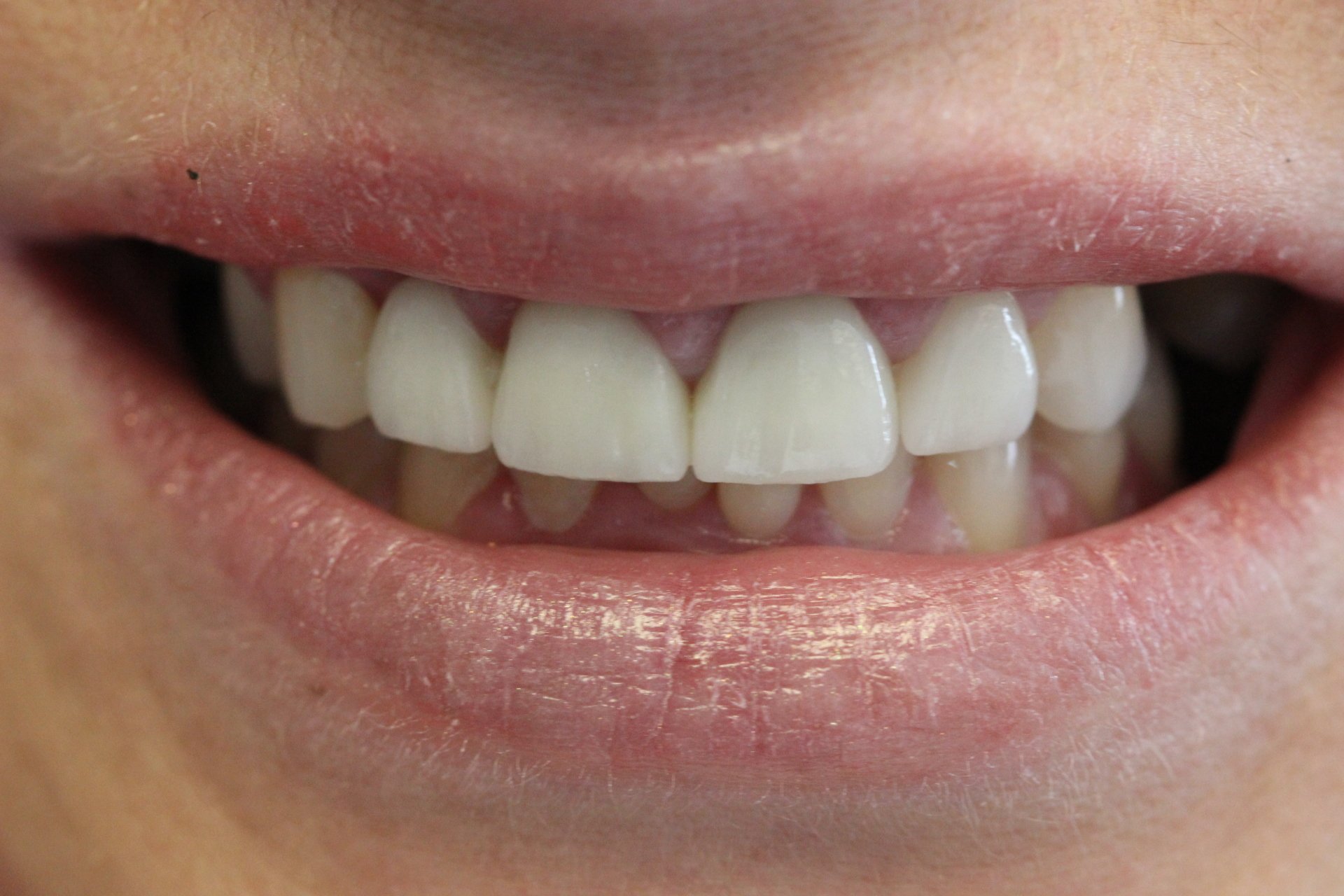 NHS & Private Dentist in StokeonTrent Pall Mall Dental