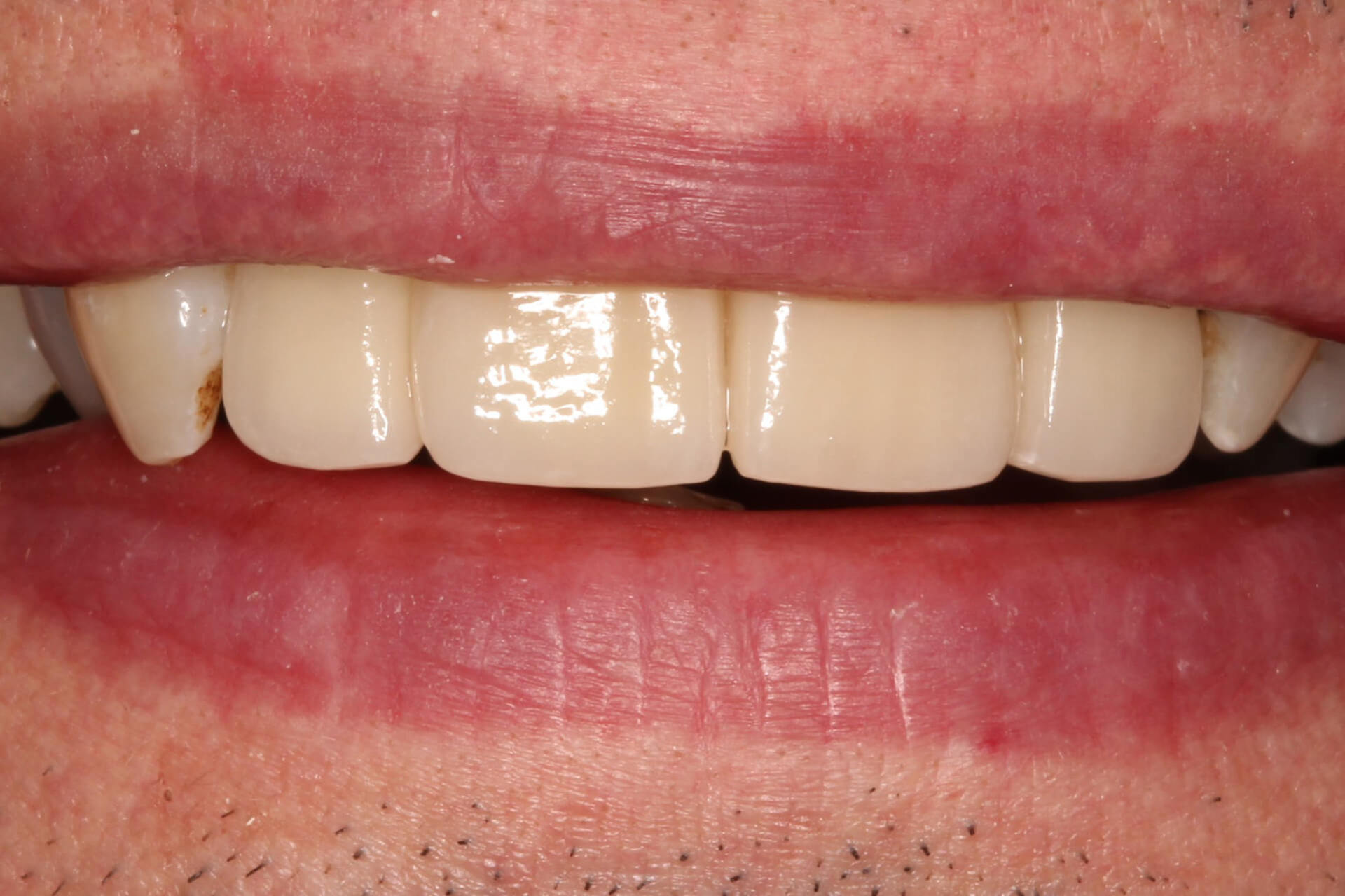 Our Before & After Smile Gallery Pall Mall Dental