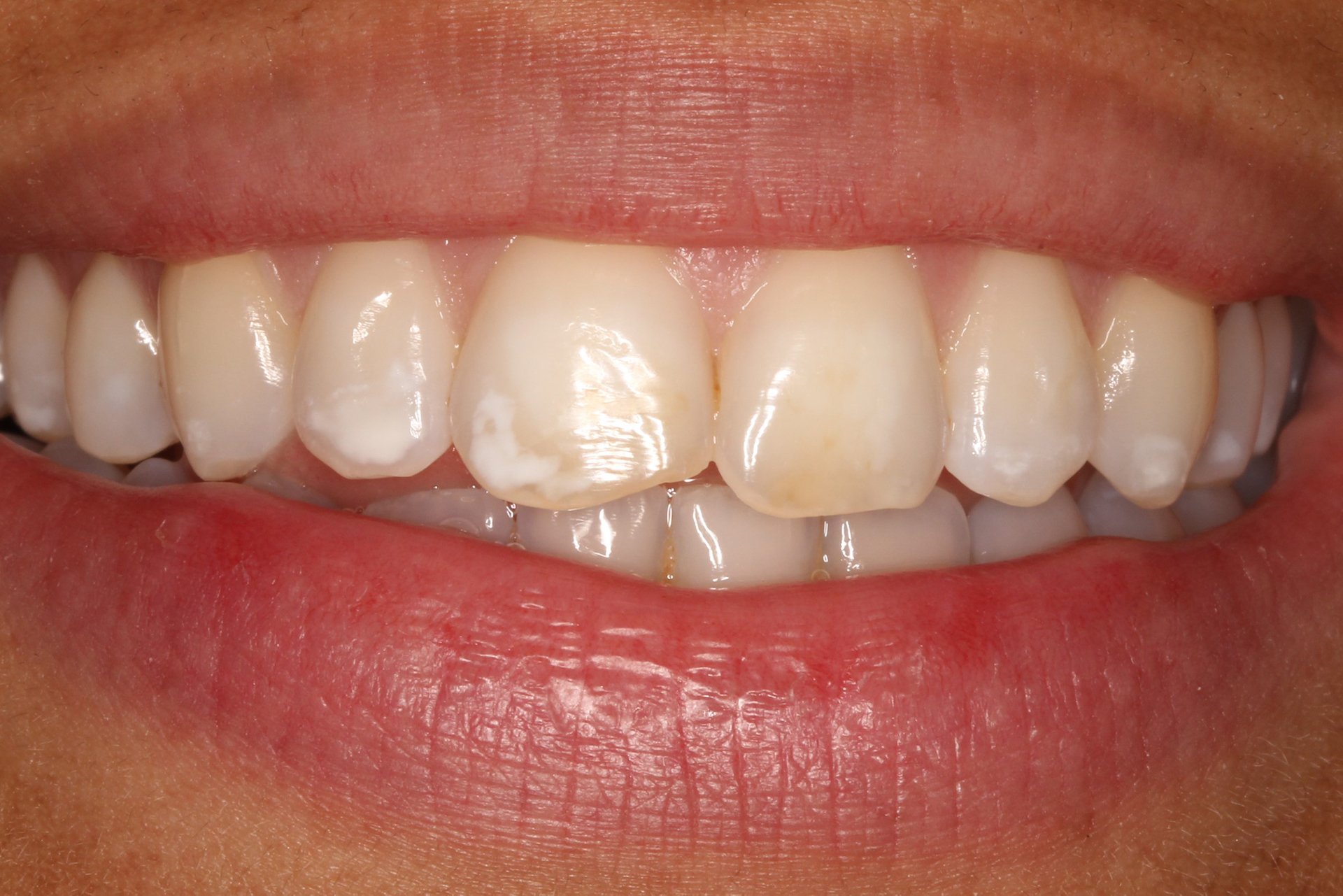 Dentist Services in Stoke-on-Trent | Pall Mall Dental
