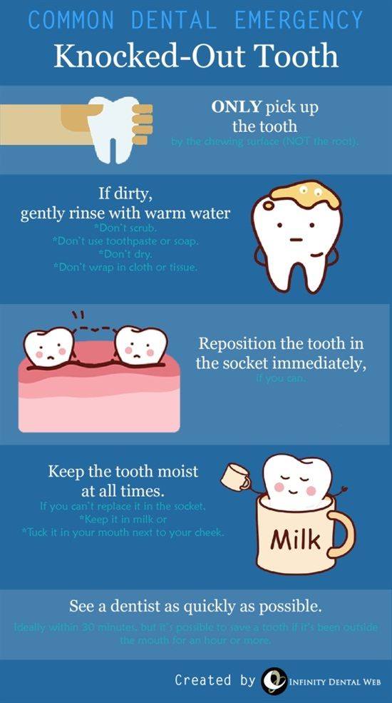 WHAT TO DO IF YOU KNOCKOUT A TOOTH