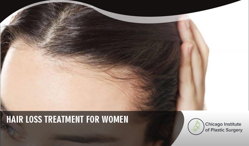 Hair loss treatment for Women