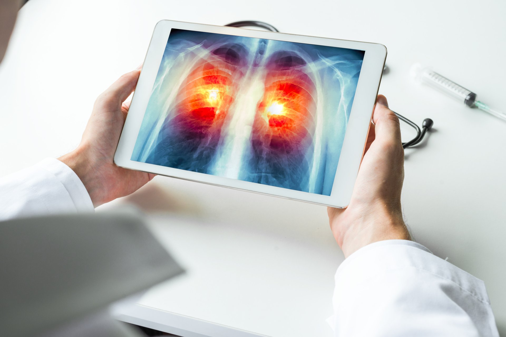 A doctor is holding a tablet with an x-ray of a patient 's lungs on it.