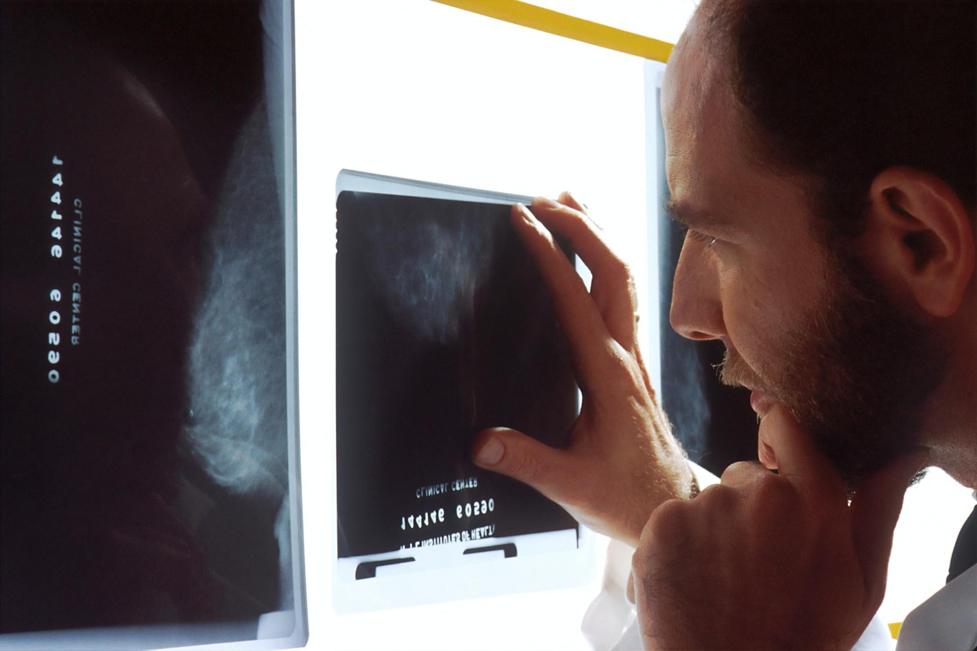 Centre Imagerie Numerisee Paris Daumesnil Radiologie Et Irm